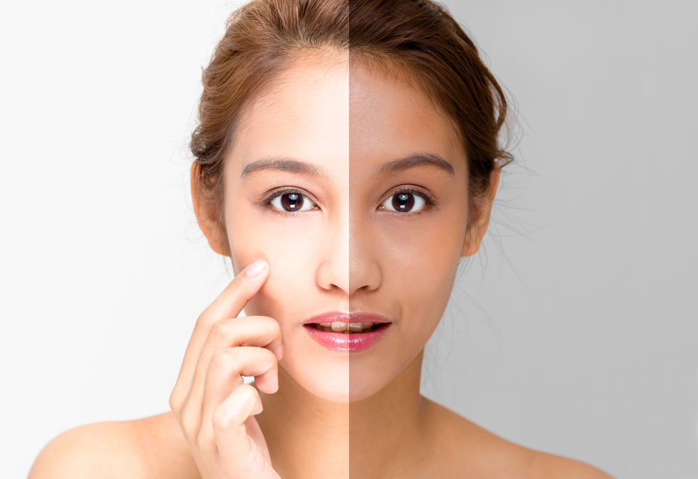 Skin Whitening: Treatment, Procedure & Cost