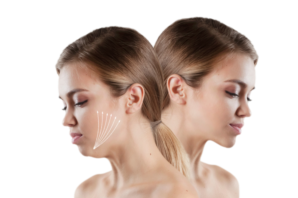 Double Chin – Causes, Treatment, and Removal