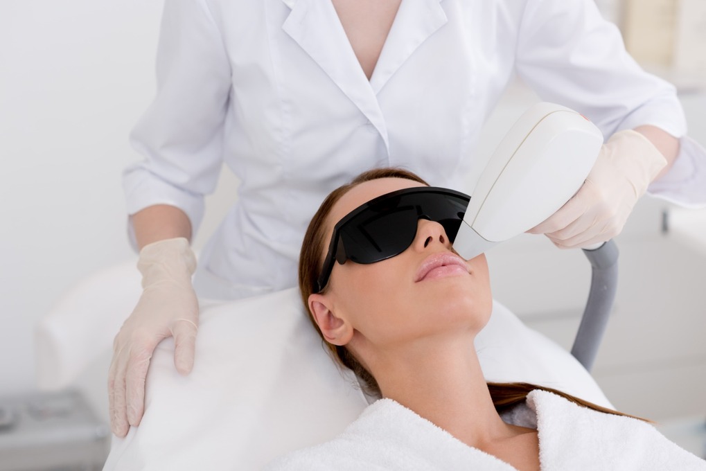 Everything to Know About Laser Hair Removal on the Face