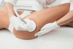 Soins anti-cellulite