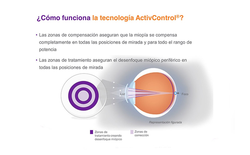 como-funciona-misight