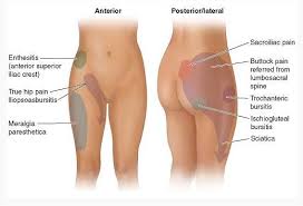 Osteopathy Massage and Acupuncture for hip problems