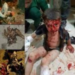 Gaziantep’teki İnsanlık Dışı Terörist Katliamı Lanetliyoruz!