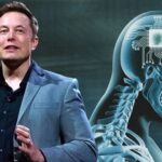 Musk'ın şirketi ilk kez beyin çipini bir insana nakletti