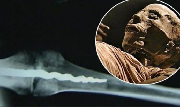OOPArts: protesi nell'antico Egitto
