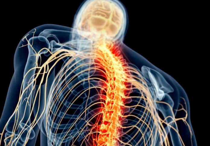 Miglioramento istantaneo della mobilità del braccio dopo l'ictus con la stimolazione del midollo spinale - video
