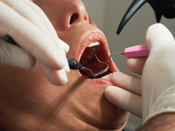 Pulizia dei denti: in che cosa consiste e perché è importante