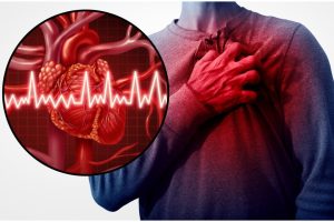 Cuore: può autoripararsi dopo un infarto? DSED