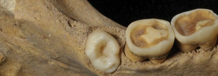 Denti fossilizzati