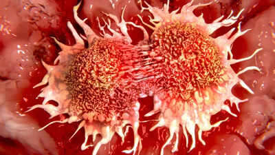 Cellule cancerose: un nuovo approccio terapeutico le trasforma in sane 1 Cellule Cancerose: un nuovo approccio terapeutico le trasforma in sane