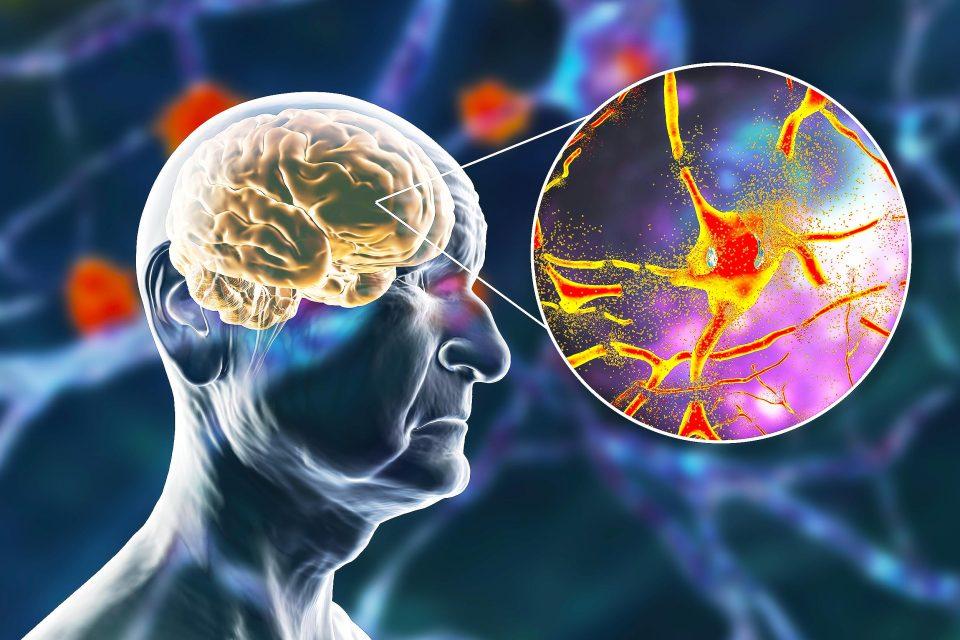 Declino cognitivo: i primi segnali da non sottovalutare 1 Declino cognitivo: i primi segnali da non sottovalutare