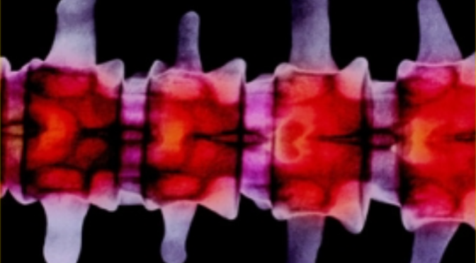 Forskarnätverk NHV ryggmärgsskada