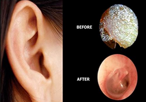 rochdale ear care clinic