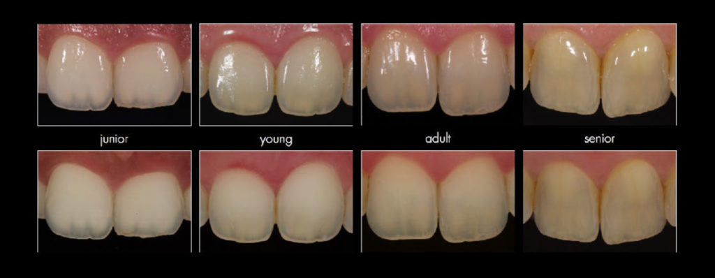 tänders struktur förändras med tiden