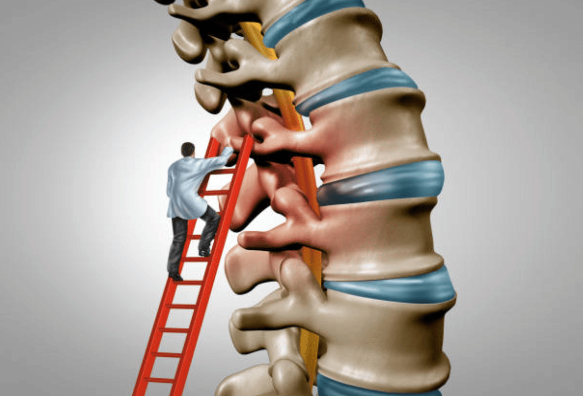 strength training after a herniated disc