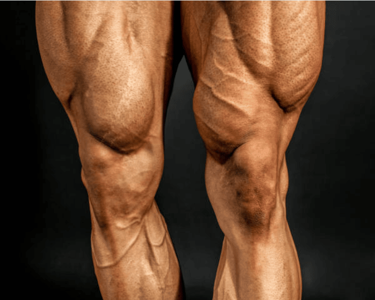 musculation cuisses