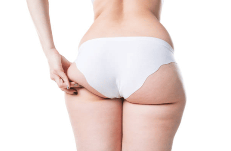 Tips for losing your saddlebags