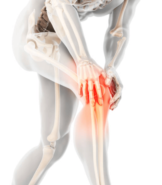 knee tendonitis