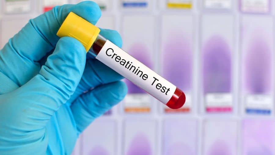 high creatinine