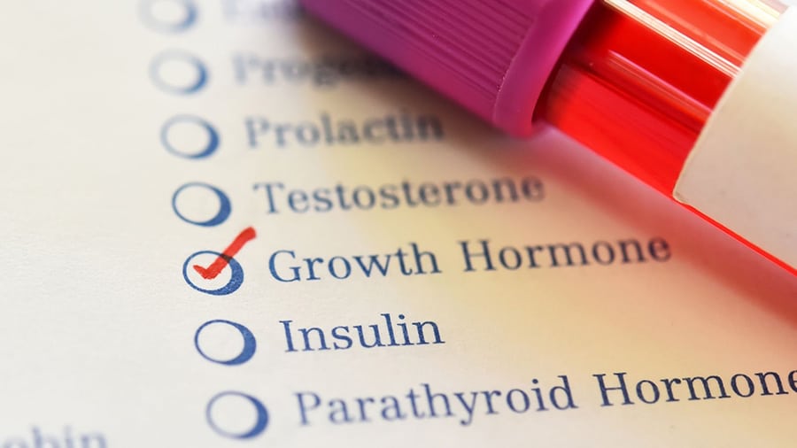 A bottle of growth hormone in front of a checklist with Growth Hormone written on it.