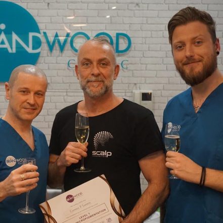 Carsten er uddannet Scalp Micropigmentation Artist i Danmark, Italien, USA og senest England