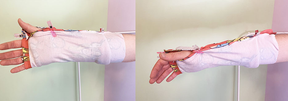 How do you cover up a Cast? A Cast Cover Fashions' Resource Guide