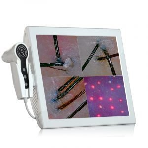 Hair and scalp analysis system