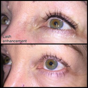 eyelash enhancement"