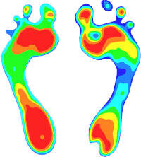 Een drukmeting van de voeten tijdens een ganganalyse vormen de eerste stap voor het maken van steunzolen op maat