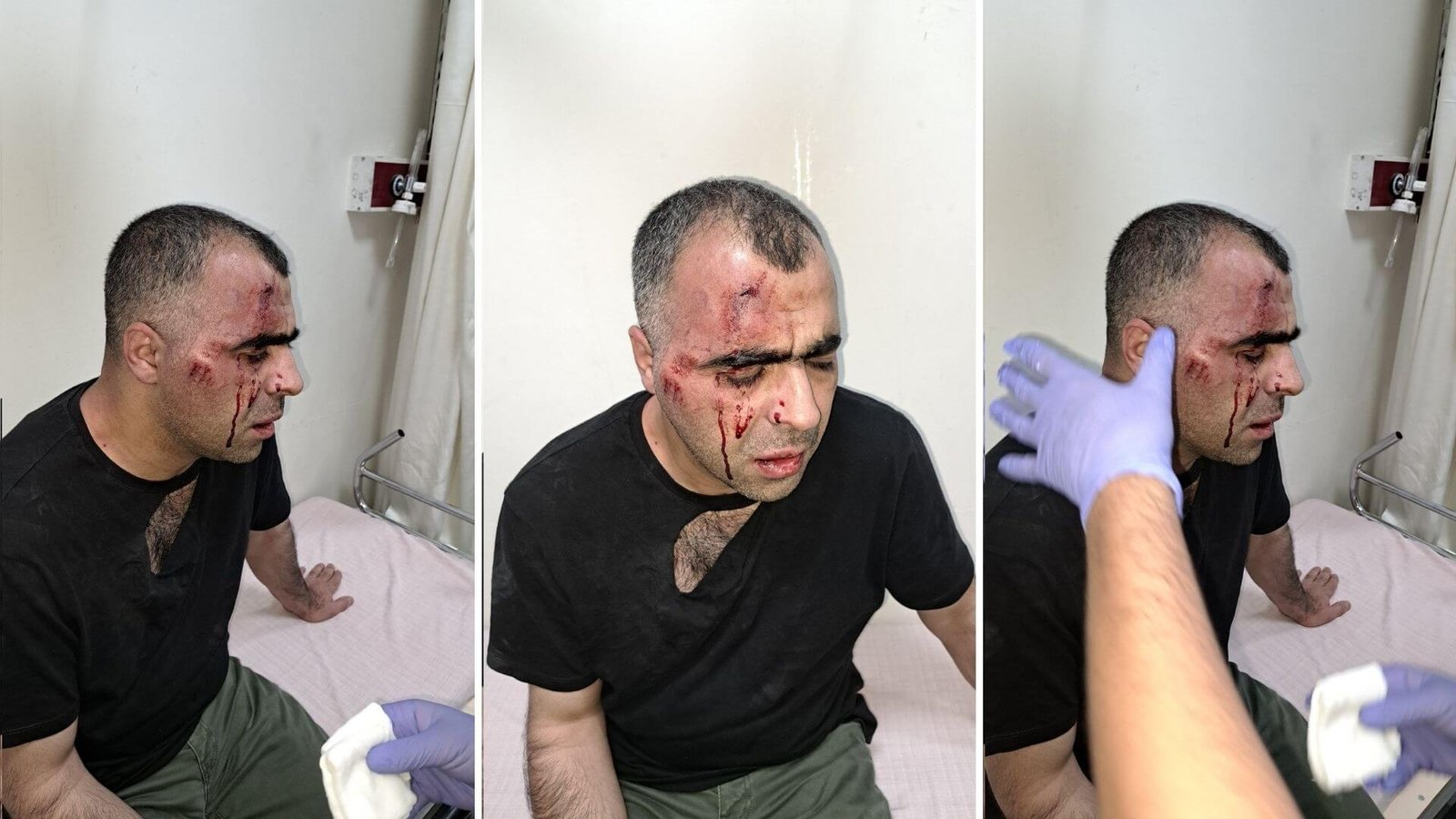 Yerel bir gazeteci, AKP belediyesinde yanlış yapıldığı iddiasını haber yaptıktan sonra Türkiye’nin doğusuna saldırdı.