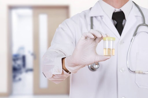 En läkare i vit rock med vita skyddshandskar håller i en mugg med ett urinprov.