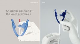 Timeline has developed a visual language for the medical industries and its conversion from physical manuals to 3D video graphics and explainer videos.