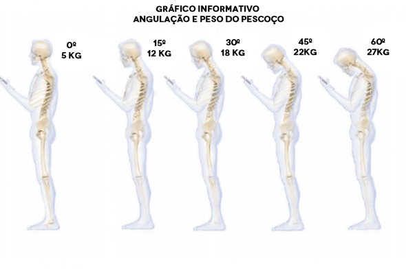 graficopescoço