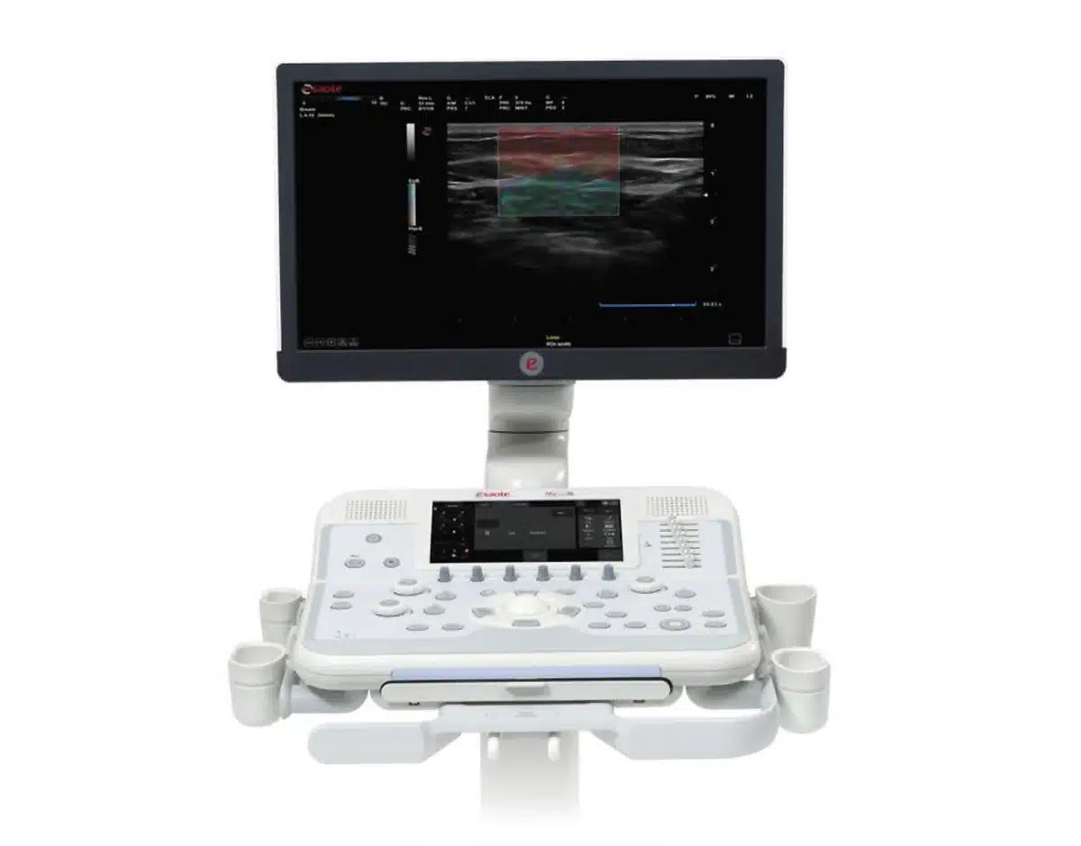 Esaote MyLab 6