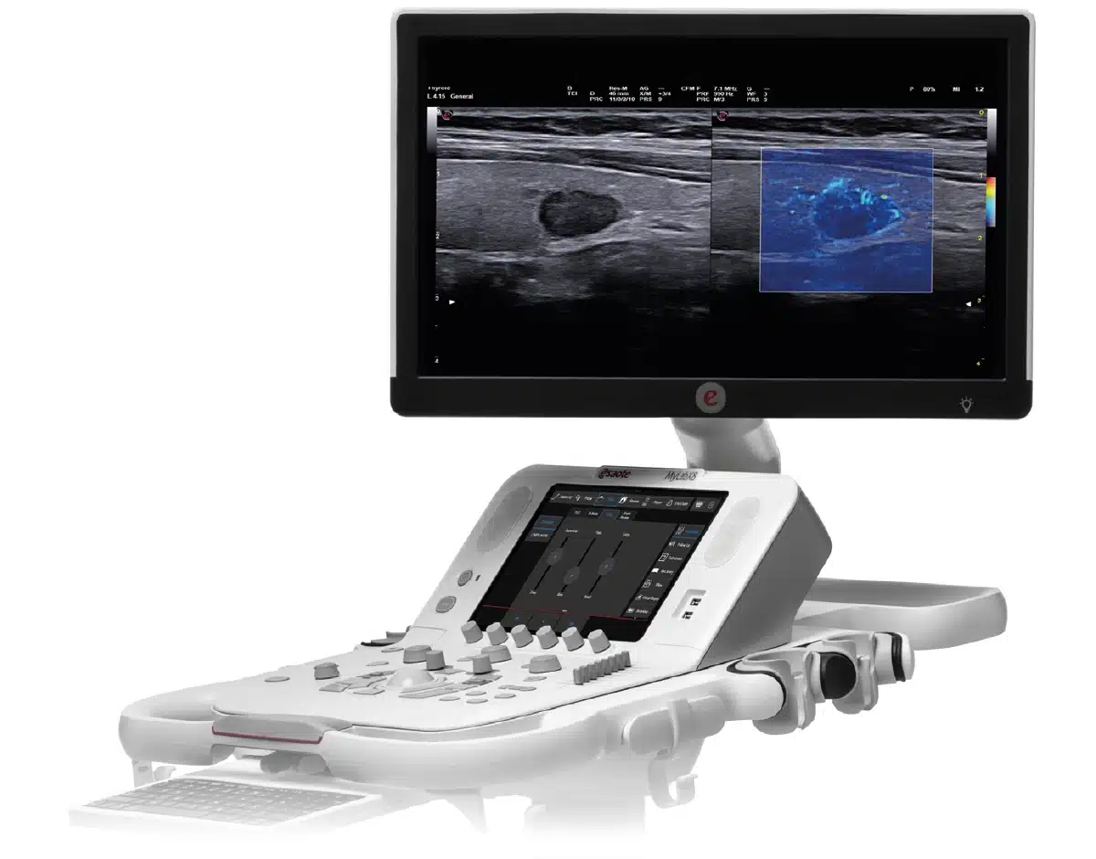 Esaote MyLabX8
