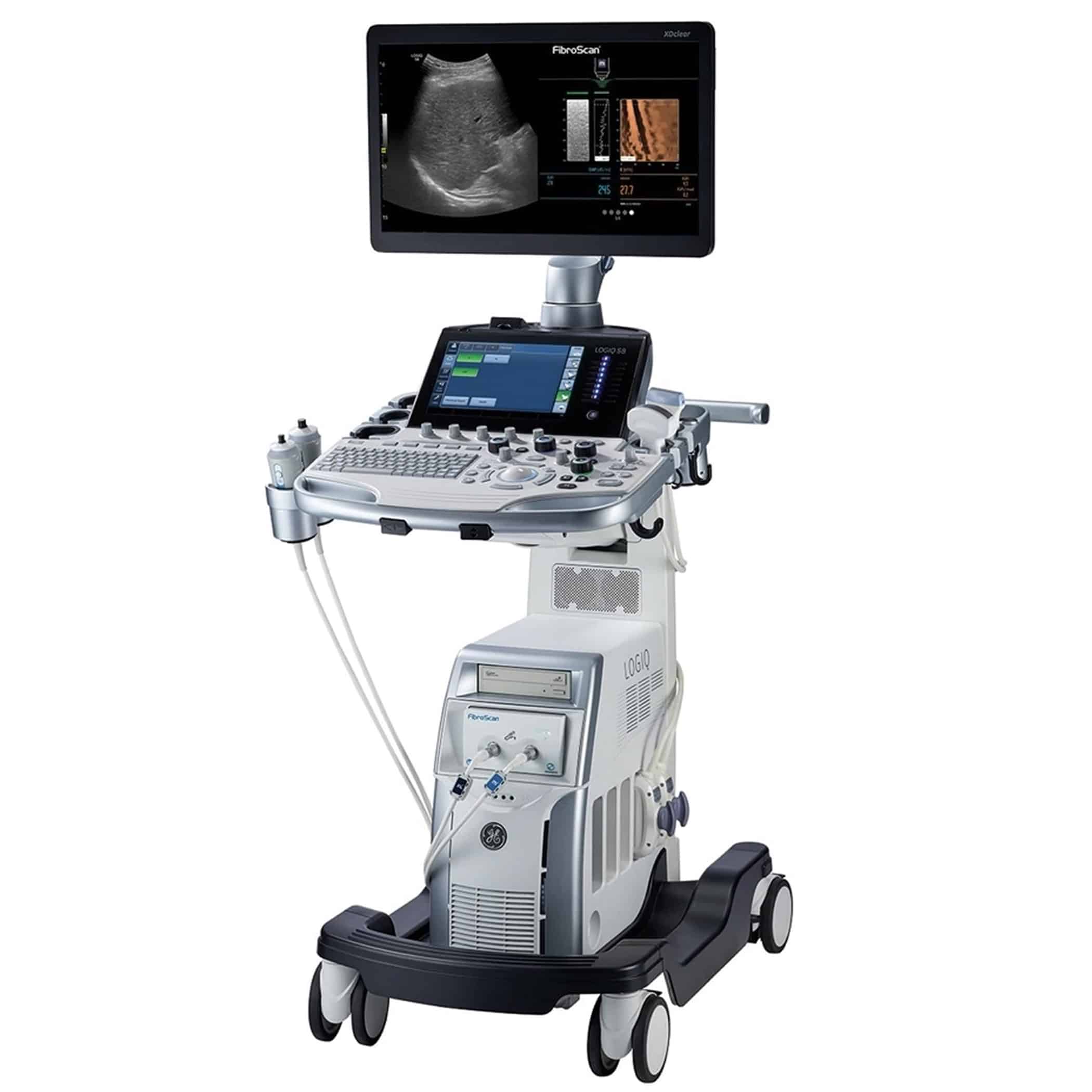 GE Logiq S8 XDclear (2)
