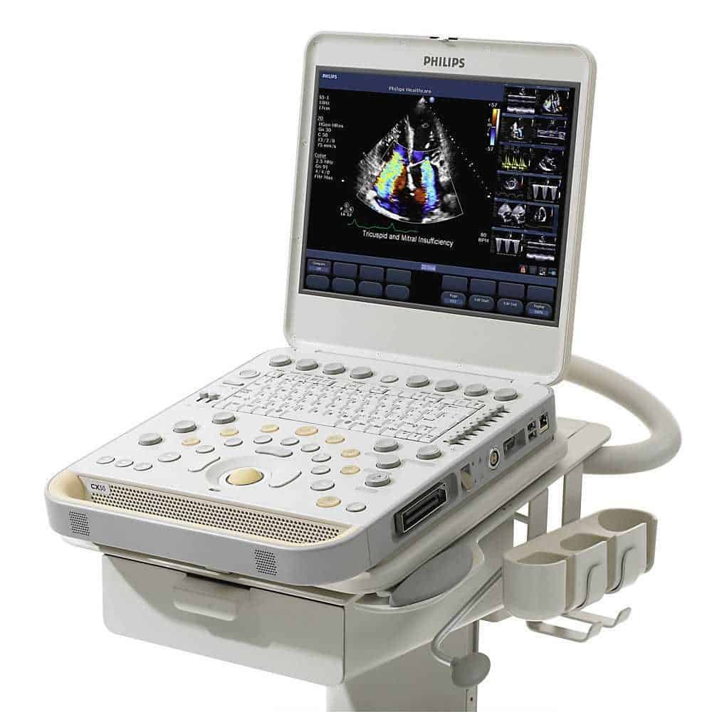 Philips CX50 (1) Philips CX50 Ultrasound
