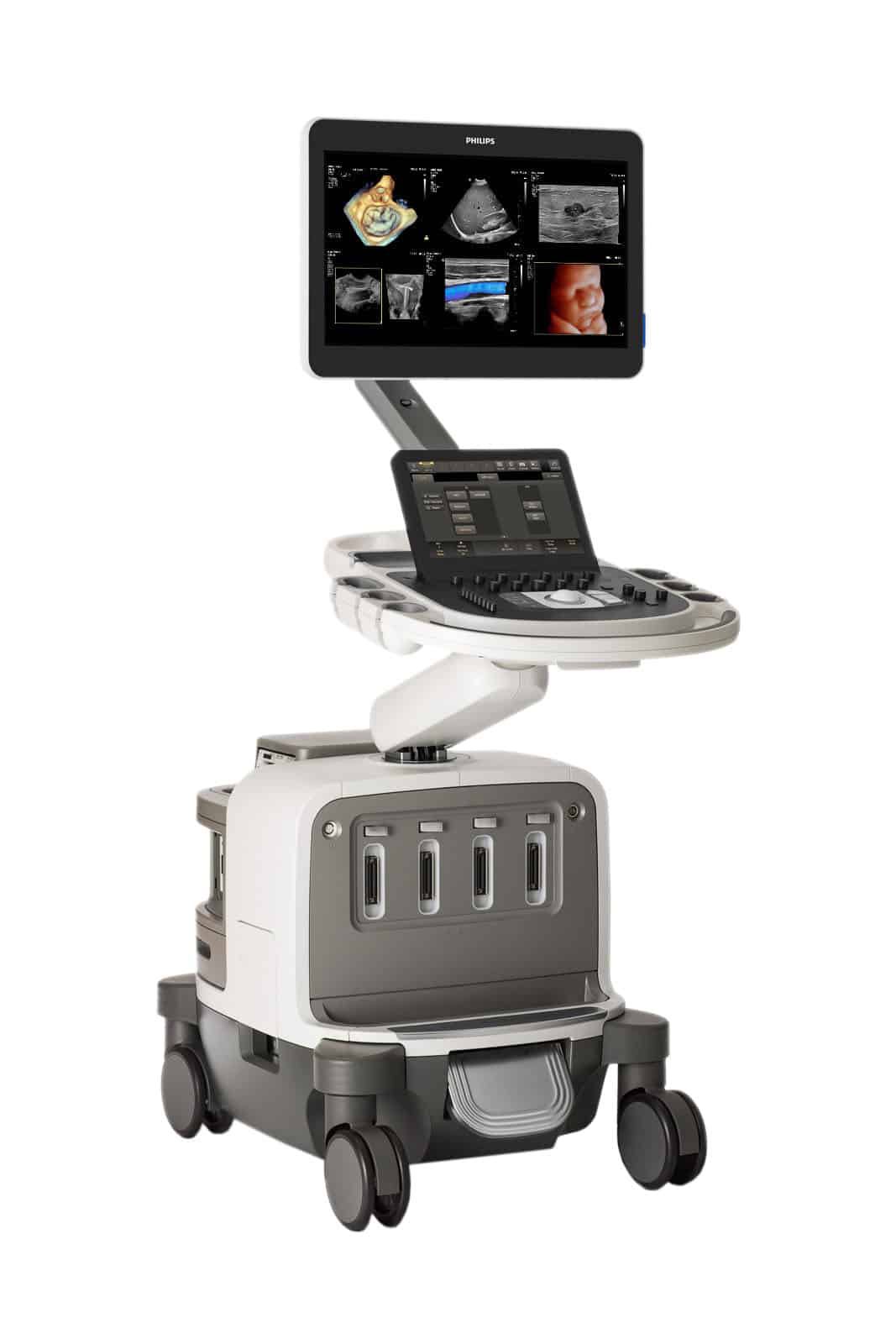 Philips EPIQ Elite Ultrasound