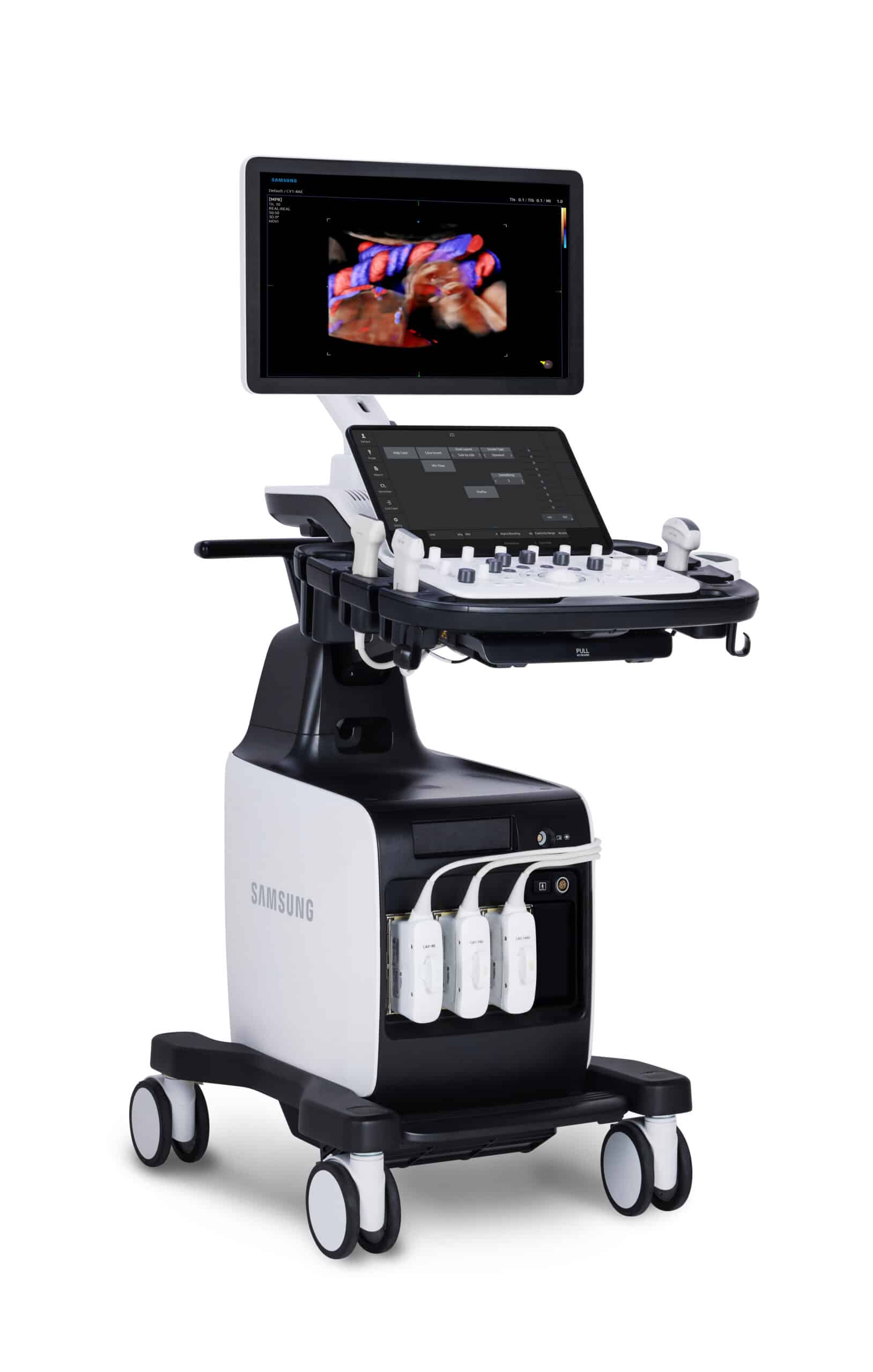Samsung V6 Ultrasound