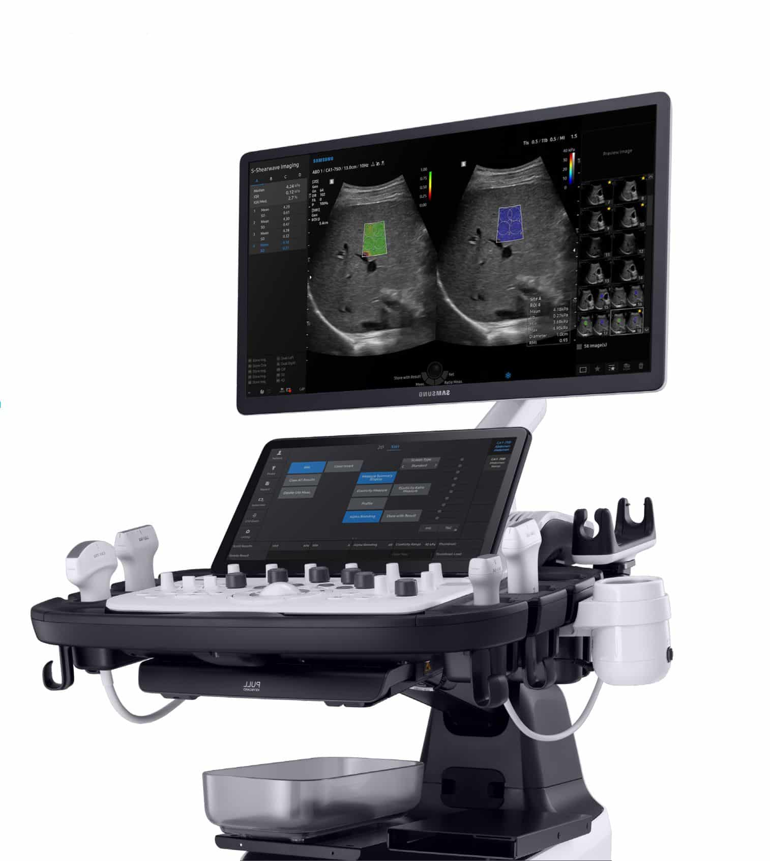 Samsung V7  Ultrasound