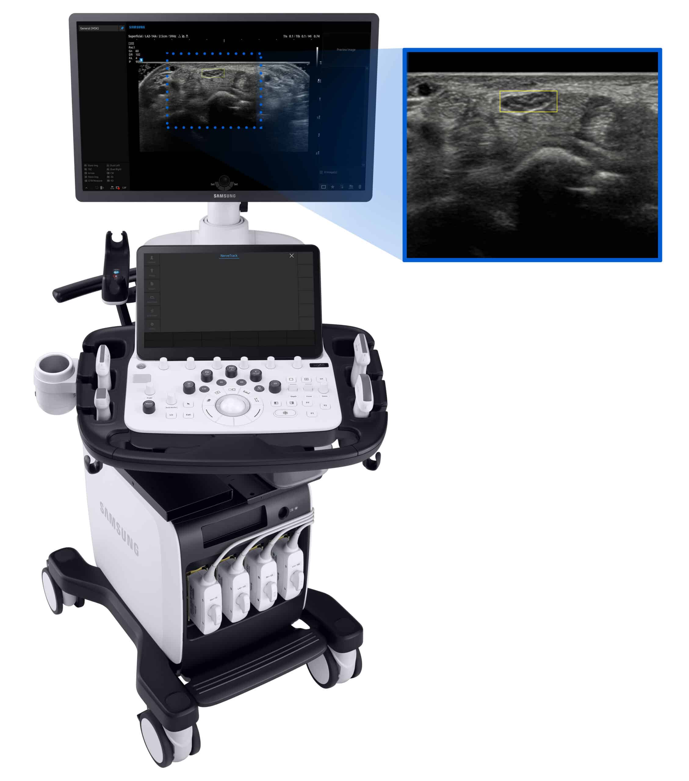  ultrasound machines