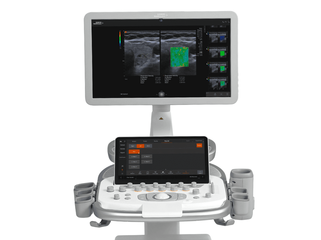 Siemens Acuson Redwood
