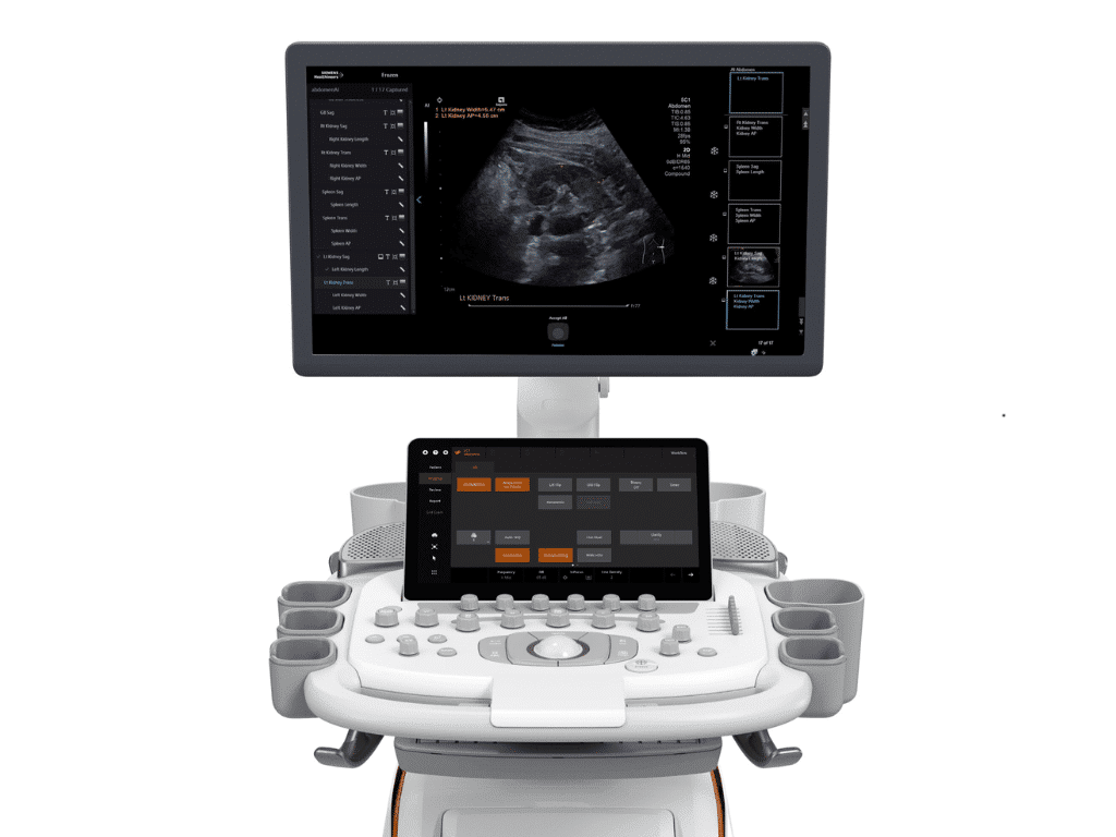 Siemens Acuson Sequoia