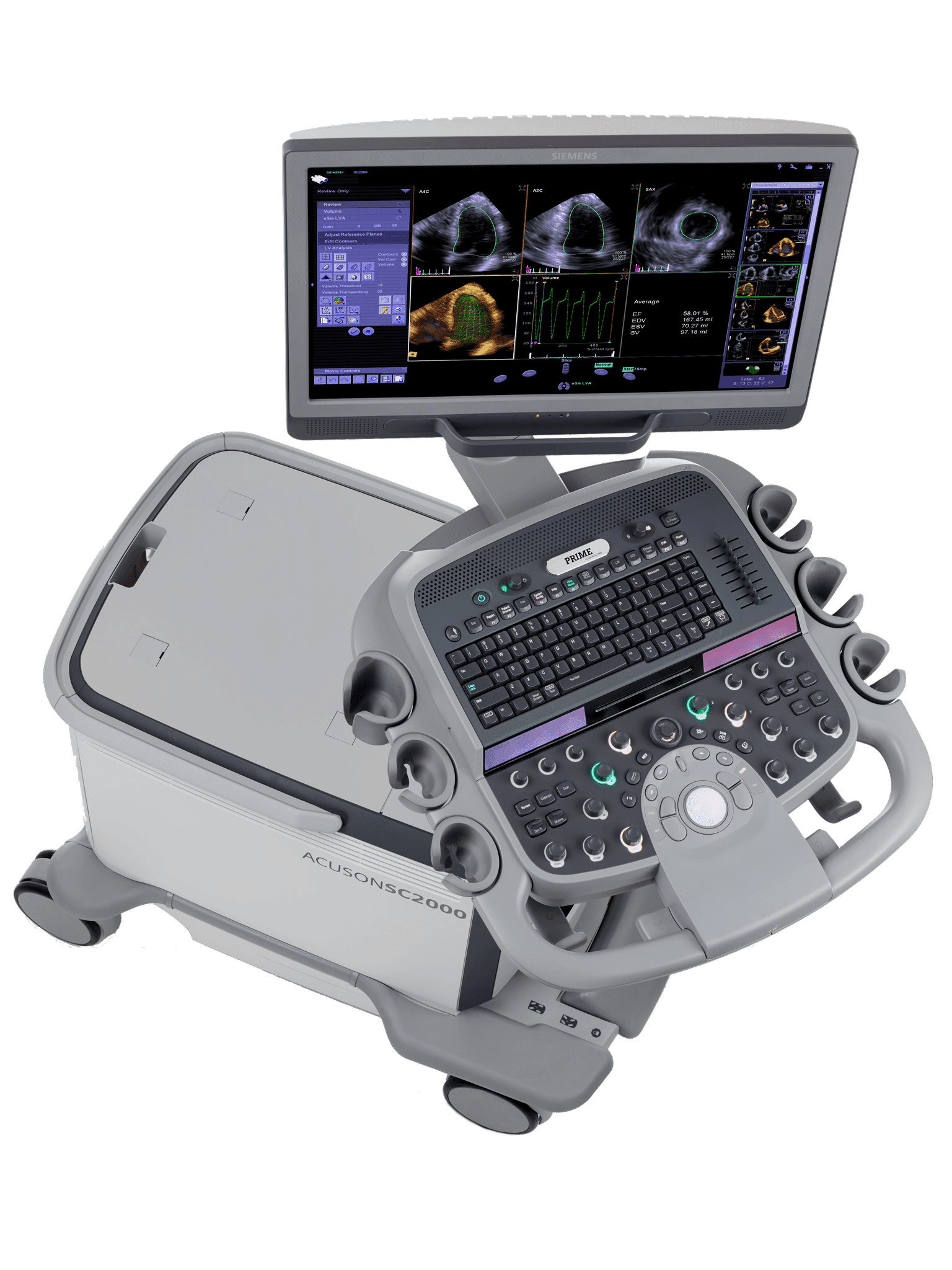 Siemens SC2000 (1) Siemens SC2000 Ultrasound