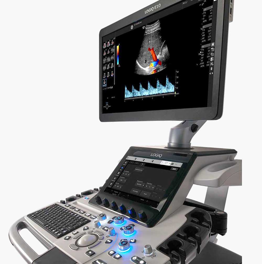 GE LOGIQ E10 (1)