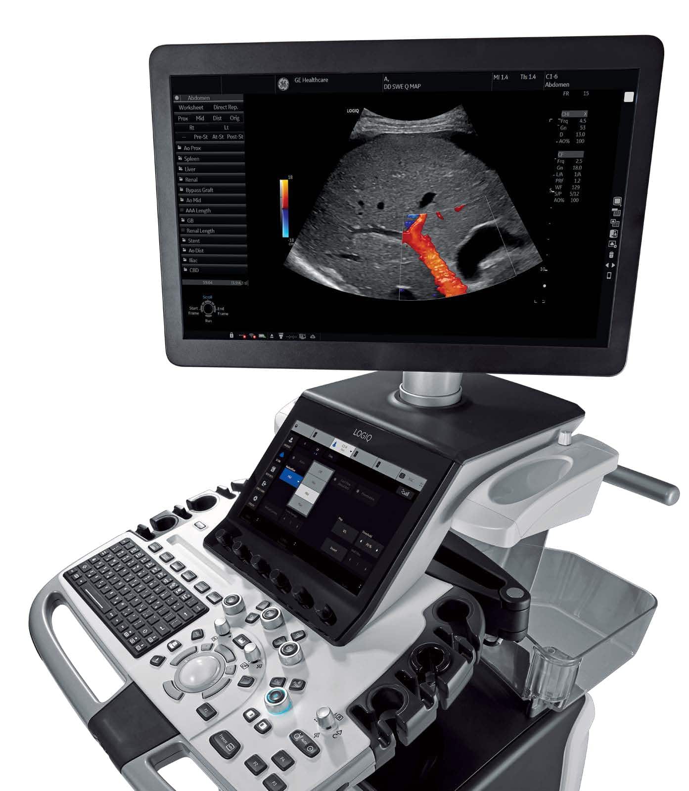 GE LOGIQ E10 (2)