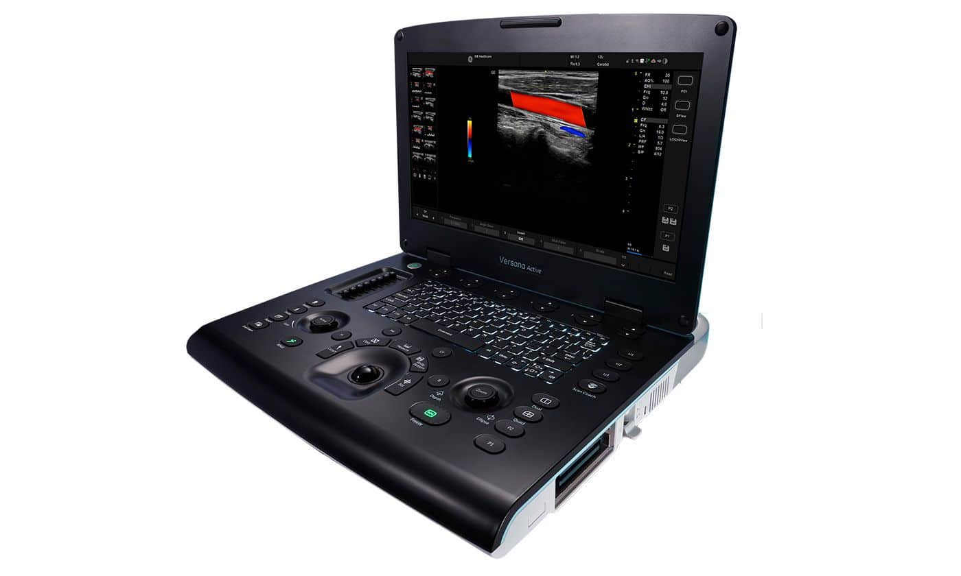 GE Versana Active (4)