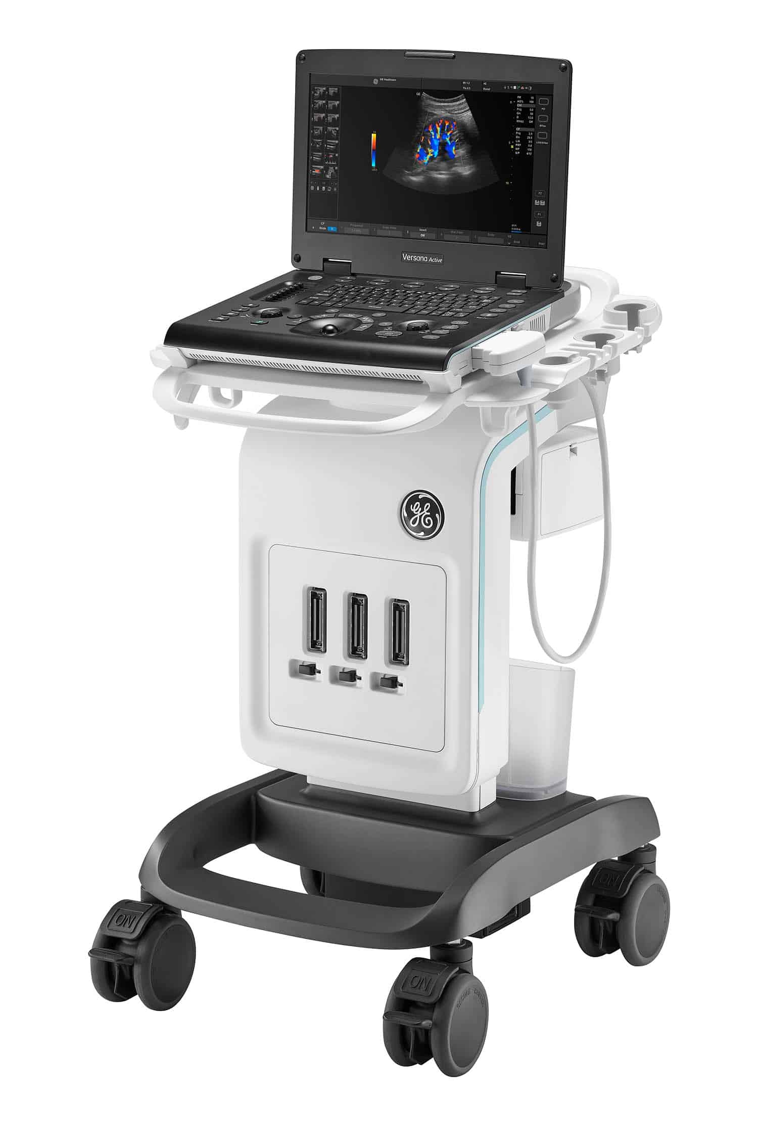 GE Versana Active Esaote MyLab X8 Ultrasound
