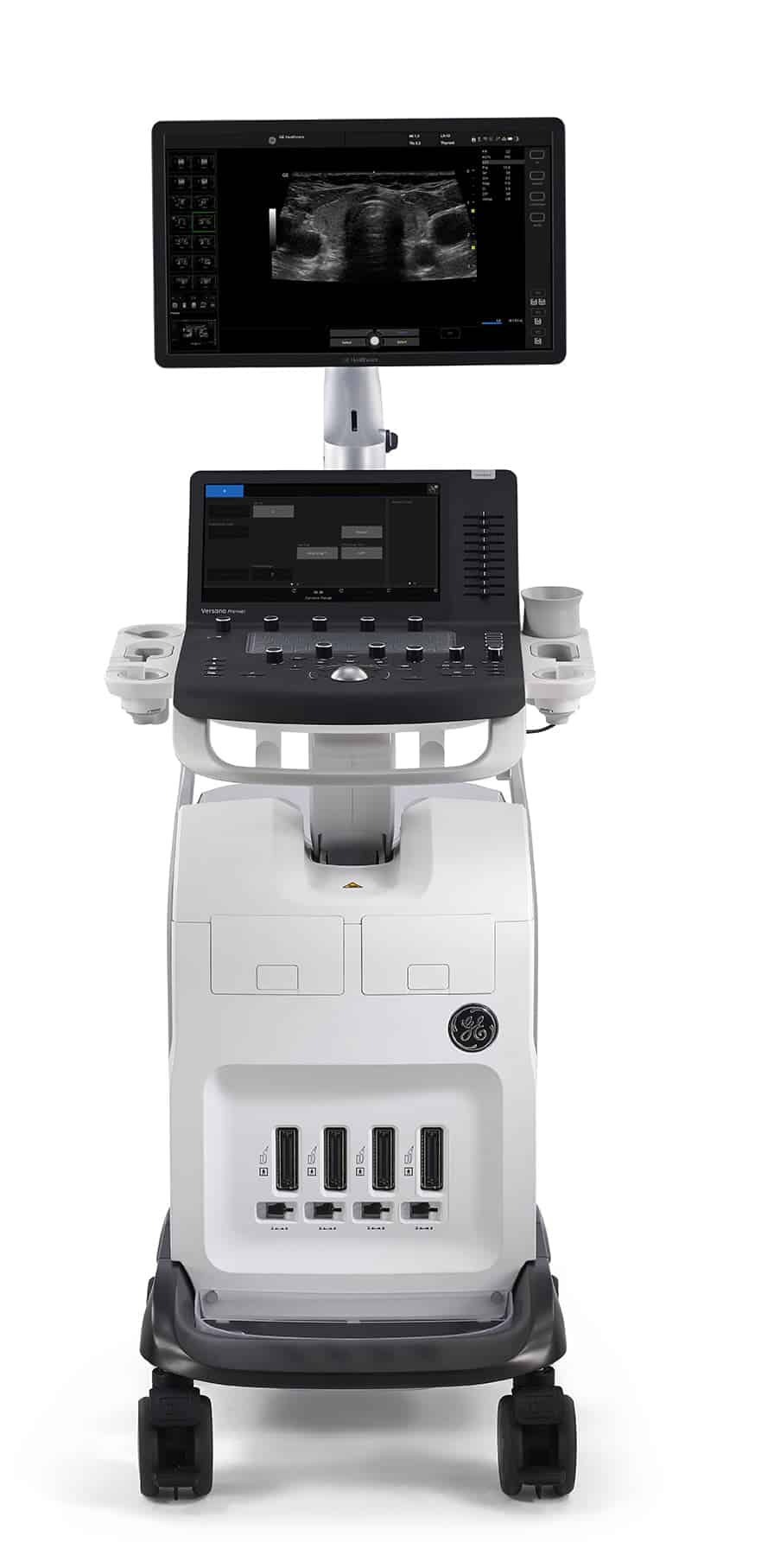 GE Versana Premier (2) Esaote MyLab X8 Ultrasound
