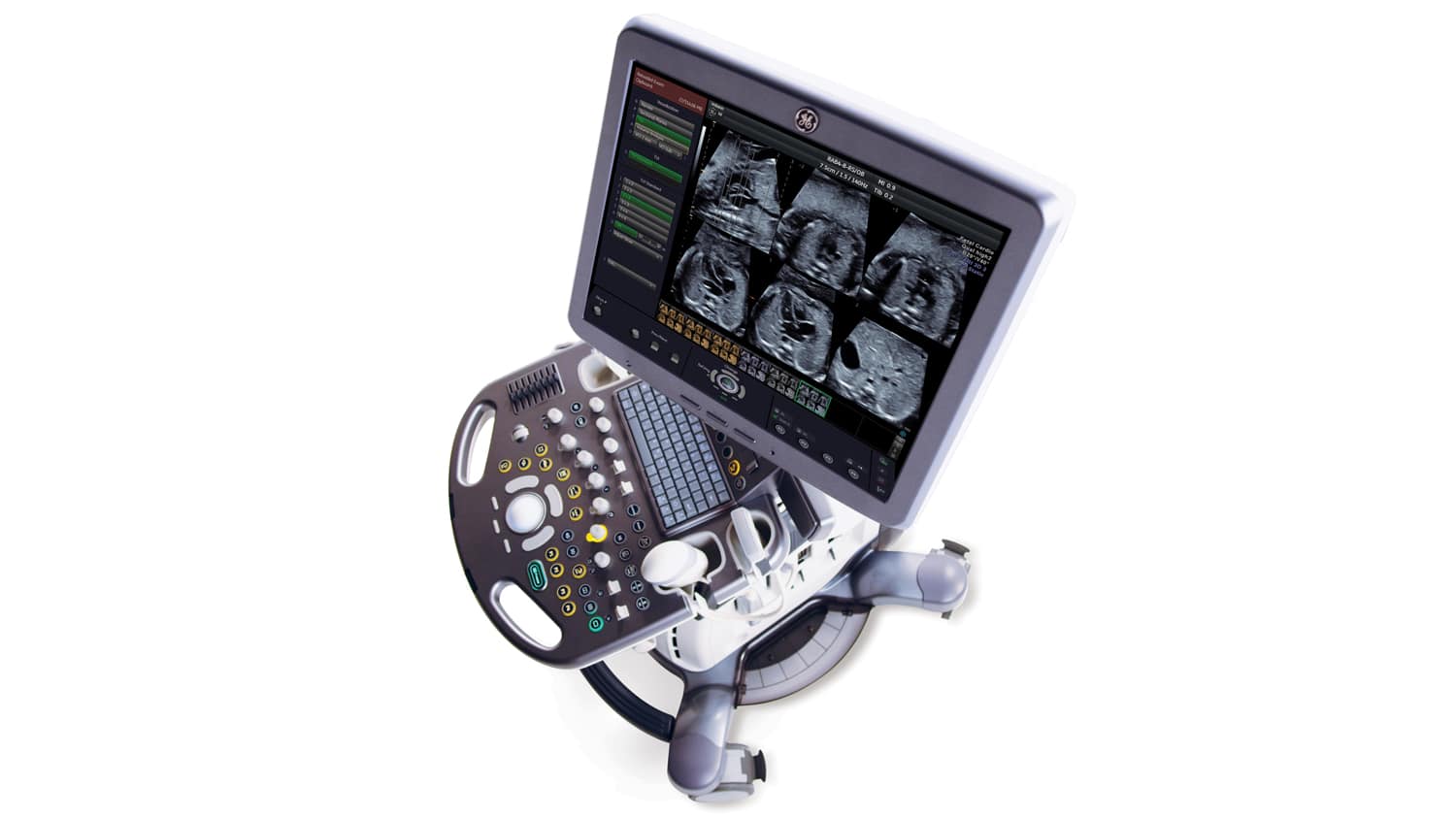 GE Voluson S8 Blue (1)